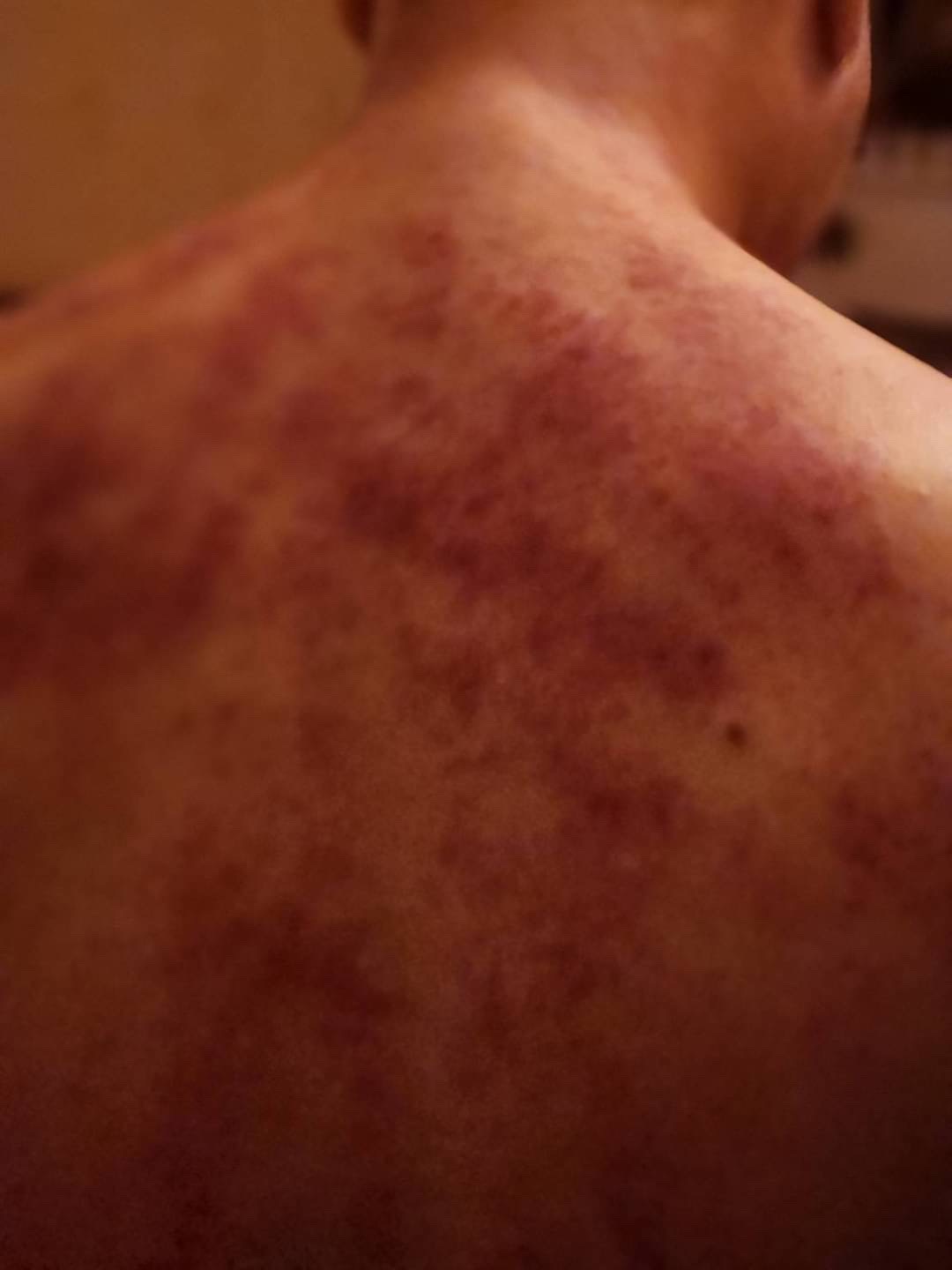 🌸 永和按摩師 玟玟 🌸