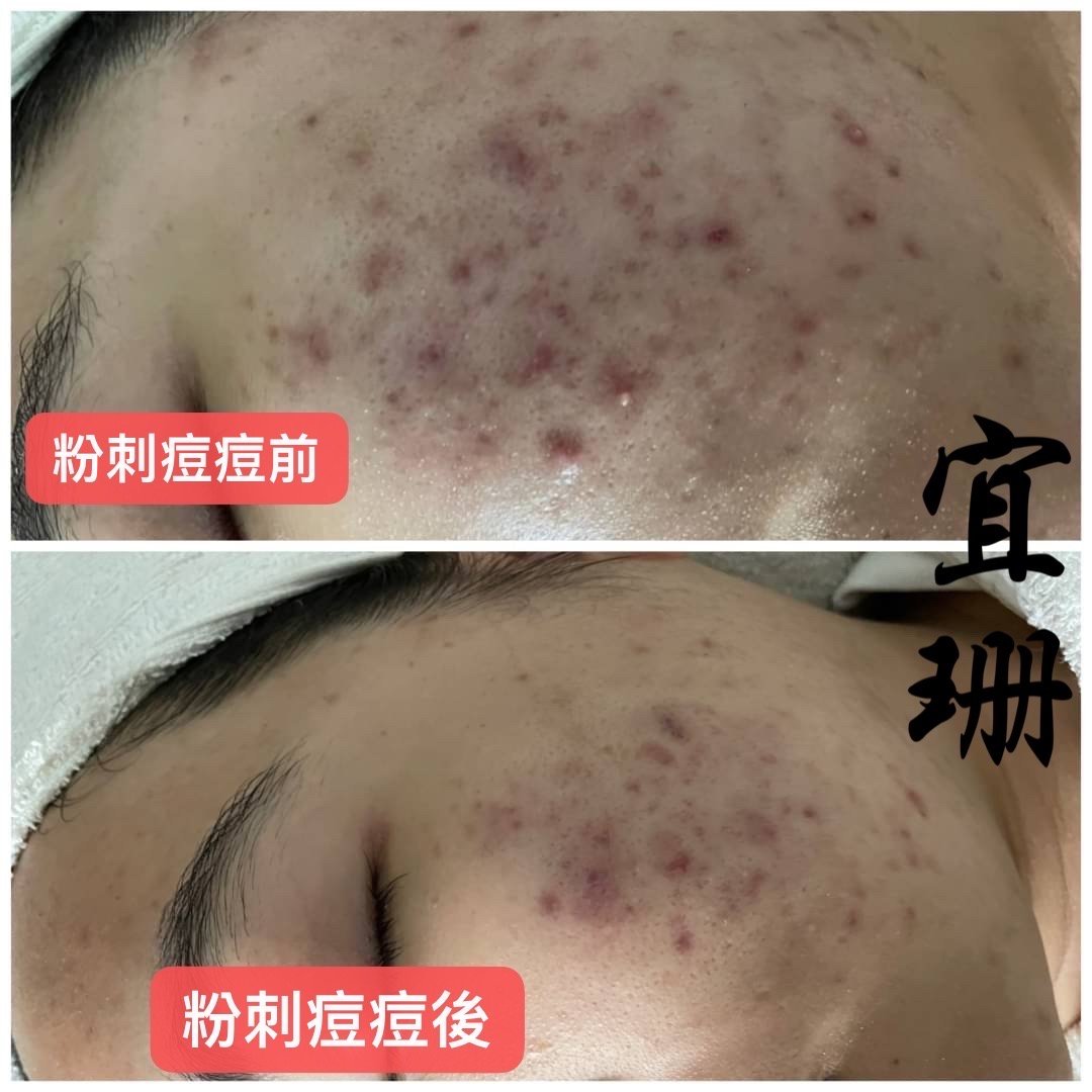 泰式龍金保養（純） 