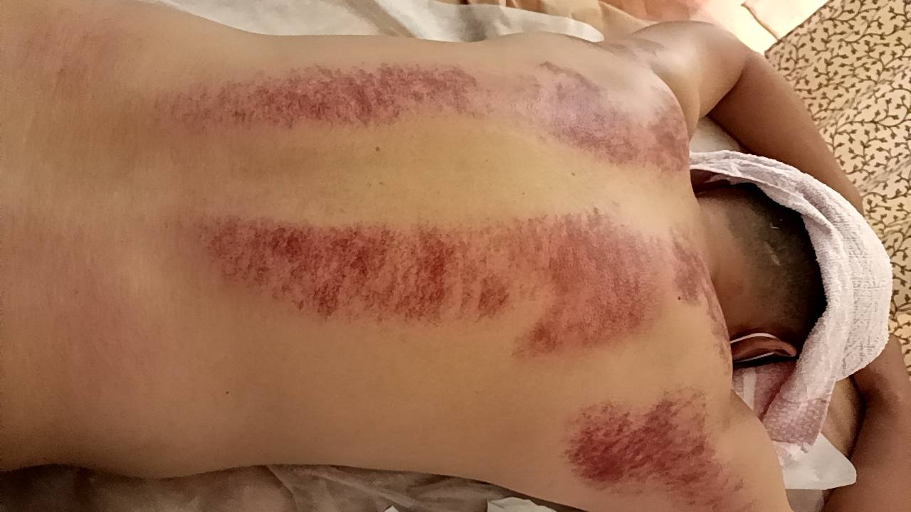 ✨小米✨正統泰式抓龍筋