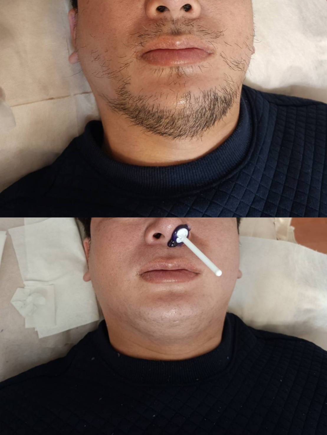 ✨小米✨正統泰式抓龍筋