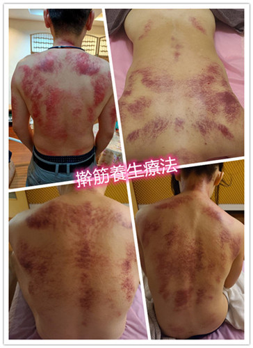 舒絜理療工作室

深層筋膜調理｜龍筋調理
經絡指油壓｜刮痧｜拔罐

專注身體放鬆與深層調整
男.女性工作室｜預約制